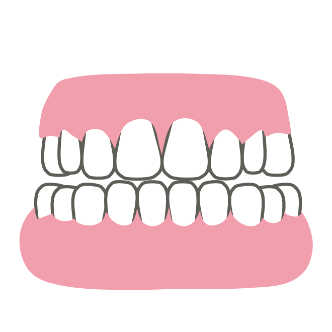 正常な歯の模型のイラスト 商用フリー 無料 のイラスト素材なら イラストマンション