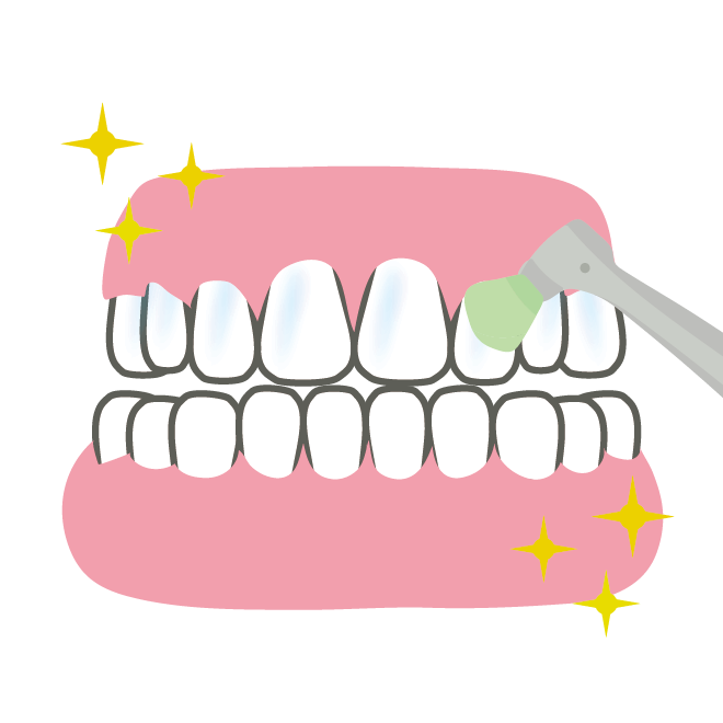 歯のクリーニング中 イラスト 商用フリー 無料 のイラスト素材なら イラストマンション